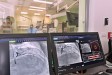 Brněnští kardiologové vyzkoušeli software pro léčbu koronárních tepen